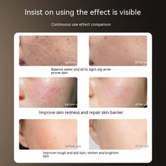 Photon IPL LED Beauty Mask